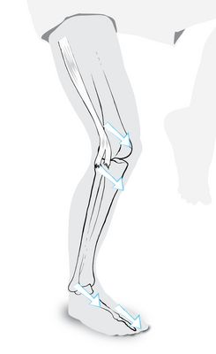 With some of its fibres, the tractus iliotibialis reaches into the lateral collateral ligament and keeps it tense also when the knee is flexed. A stabilised knee joint shows in the position of the leg with thigh bone, tibia, talus and foot (2nd toe) all pointing in the same direction.